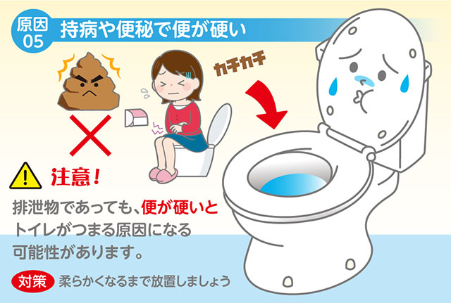 トイレが詰まる原因➄　持病や便秘で便が硬い