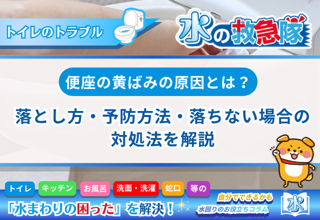 便座の黄ばみの原因とは？落とし方・予防方法・落ちない場合の対処法を解説
